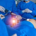 Cirugía Laparoscópica de Vesícula Guayaquil Cirugía Laparoscópica Vesicula Guayaquil Dr Ricardo Garcia-min