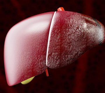 Daño hepático Tratamiento Guayaquil Dr Ricardo García-min