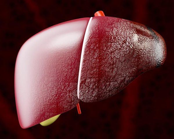 Daño hepático Tratamiento Guayaquil Dr Ricardo García-min