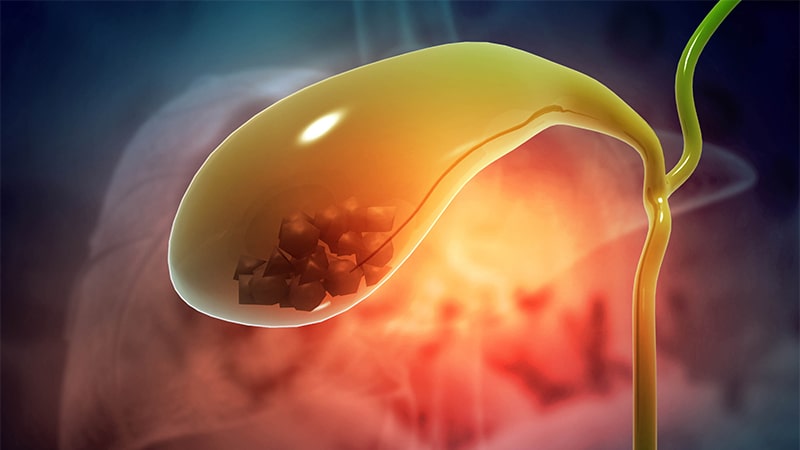 Cirugía de vesícula Cirujano General Guayaquil Dr Ricardo García Clínica Kennedy Samborondon-min