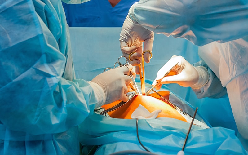 Tumor de Páncreas Cirugia Tratamiento Guayaquil Dr Ricardo García-min Tumor de Páncreas Cirugia Tratamiento Guayaquil Dr Ricardo García-min