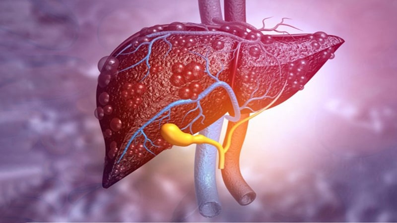 Tumor higado tratamiento cirujano de higado hepatólogo Guayaquil Dr Ricardo Garcia-min